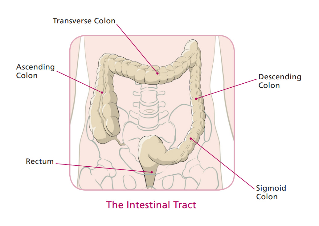HCA Virginia Colorectal Cancer Robotic Minimally-Invasive Surgery